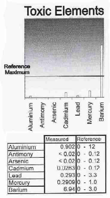 Reference Range for Toxic Elements Chart plus Test Results as shown in a hair analysis test